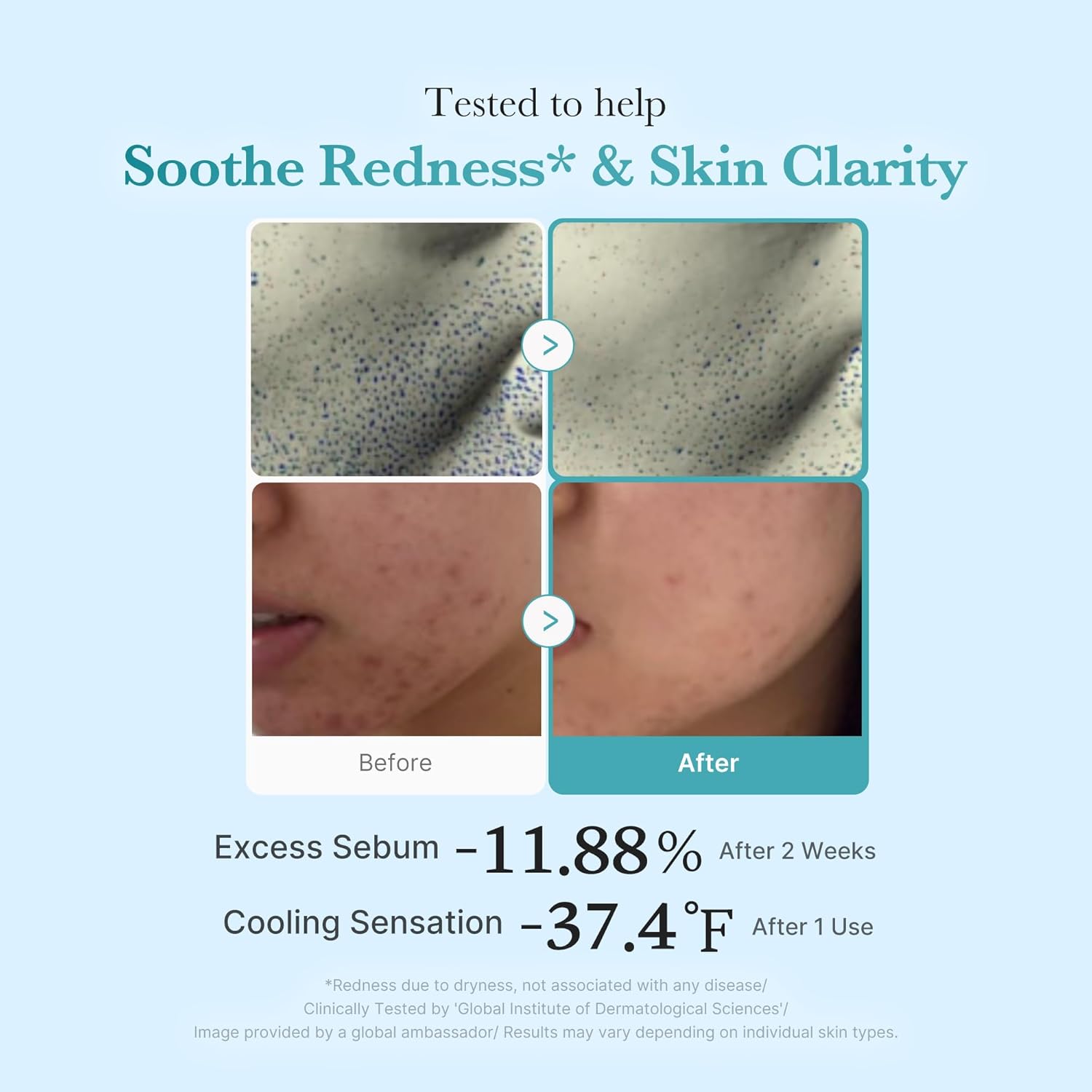 Medicube Azelaic Acid Niacinamide Clarifying Toner - Image 6