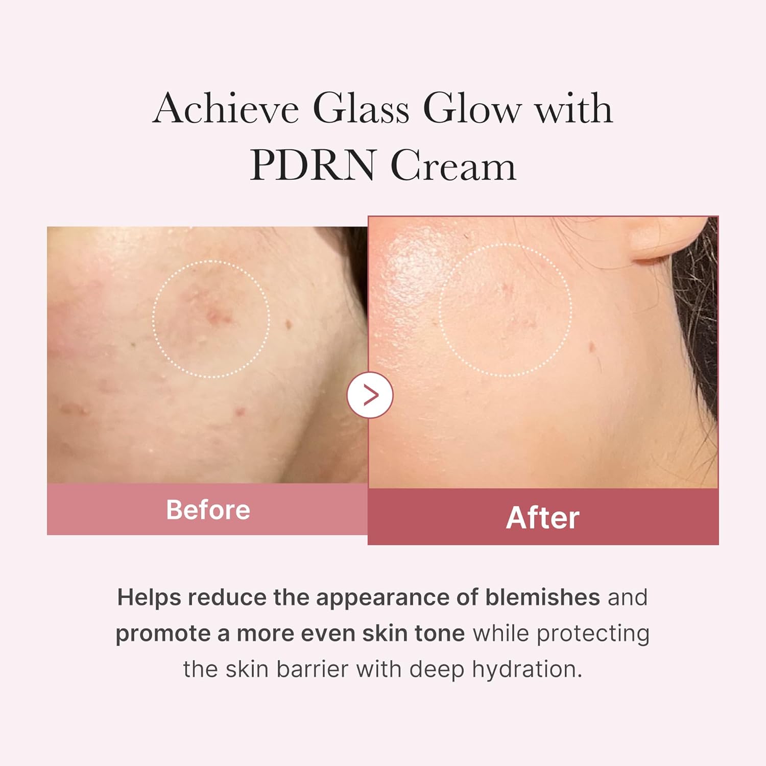 Medicube PDRN Pink Hyaluronic Moisturizing Cream - Image 4