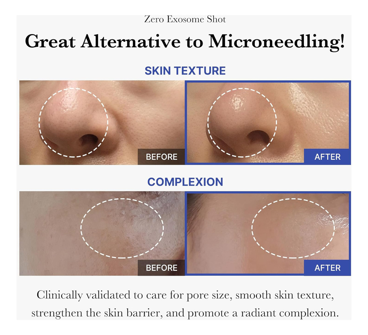 Sérum Facial Medicube Zero One Day Exosome Shot 7500 Ppm Spicule - Image 5