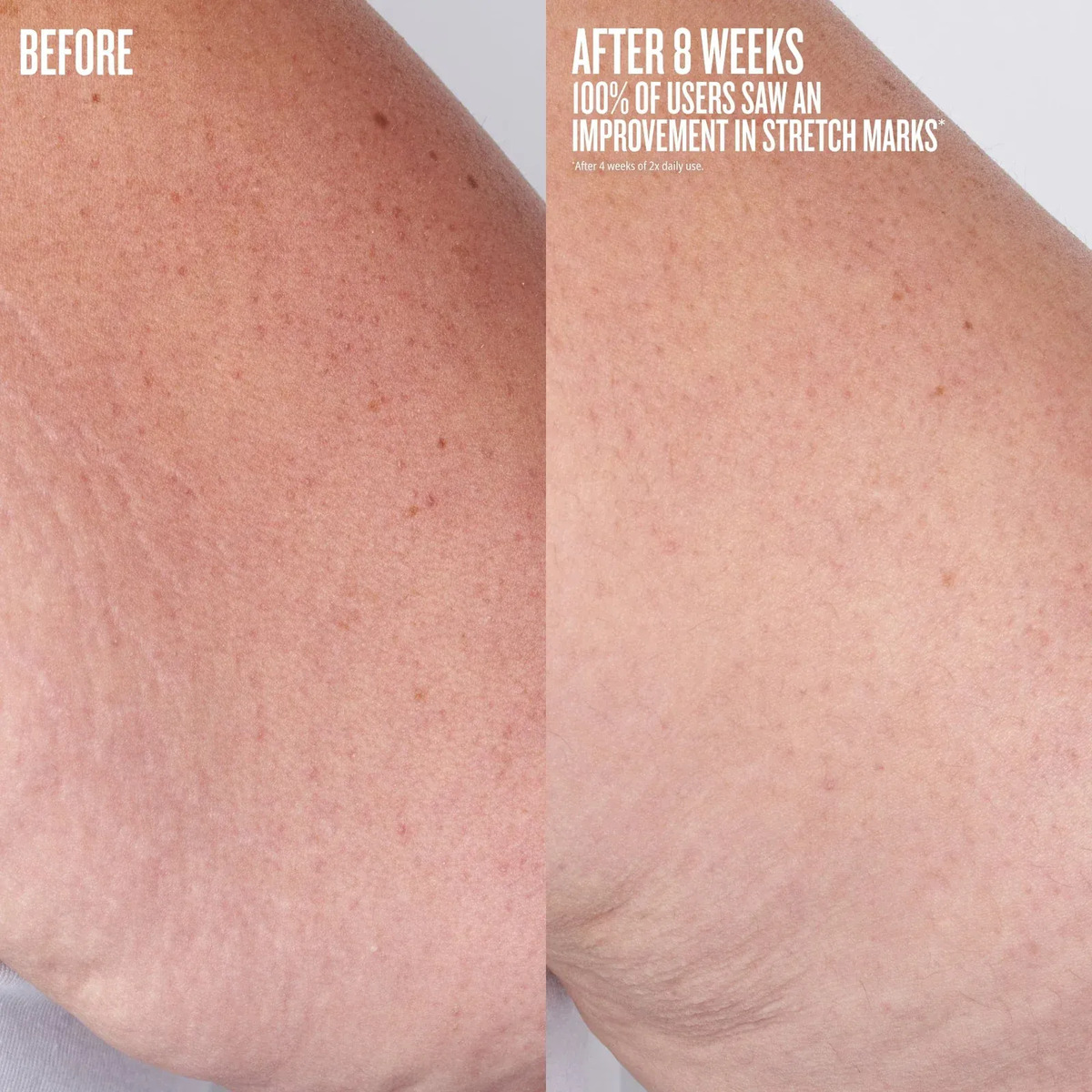 Sol De Janeiro Elasti-body Oil Aceite Corporal Antiestrías - Image 4