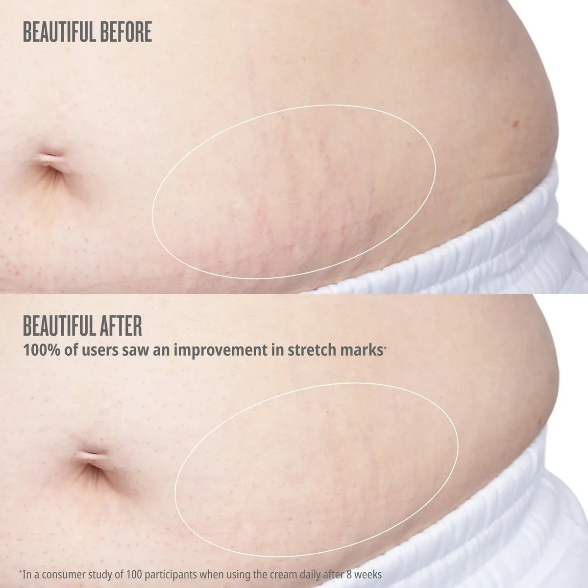 Sol De Janeiro Elasti-body Oil Aceite Corporal Antiestrías - Image 5