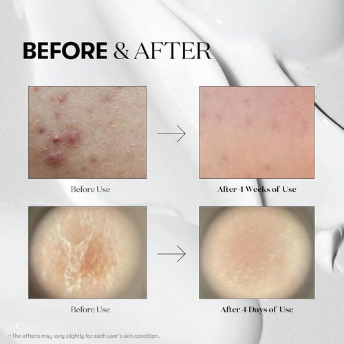 Vt Cosmetics Reedle Shot 300 Suero Microagujas Exosomas - Imagen 4