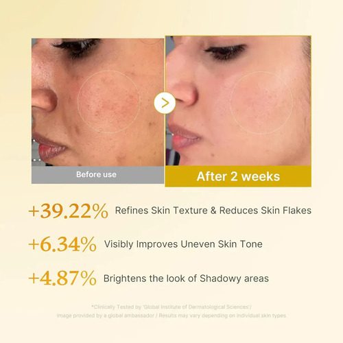 Medicube Kojic Acid Turmeric Resurfacing Toner - Imagen 2