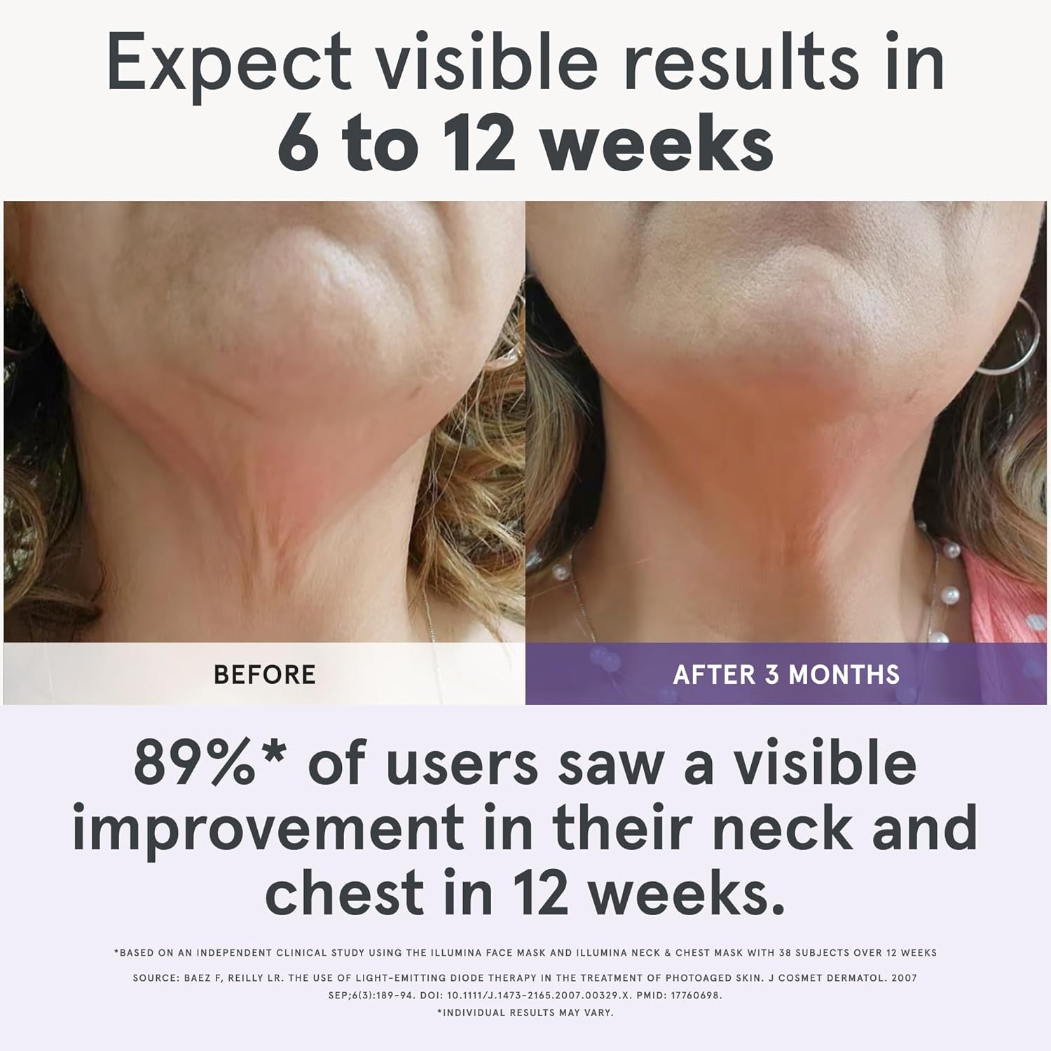 iRestore Illumina LED Neck & Chest Anti Aging Mask - Imagen 5