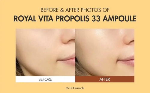 Dr.ceuracle Royal Vita Propolis 33 Ampoule Serum Iluminado - Image 6