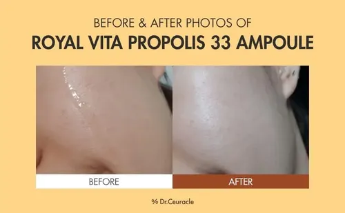 Dr.ceuracle Royal Vita Propolis 33 Ampoule Serum Iluminado - Image 5