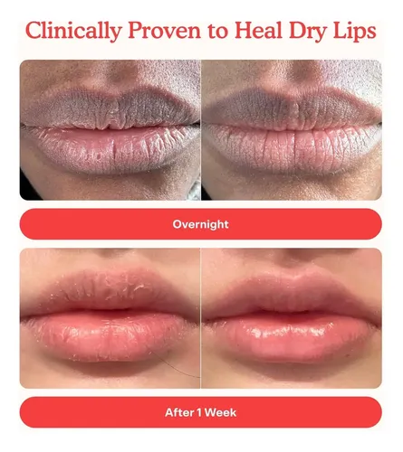 Tower 28 Lipsoftie Lipstick - Repara Labios Agrietados - Imagen 3