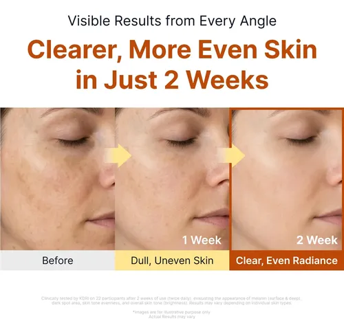 Sungboon Glow Intensive Kojic Acid Serum Disminuye Manchas - Imagen 5
