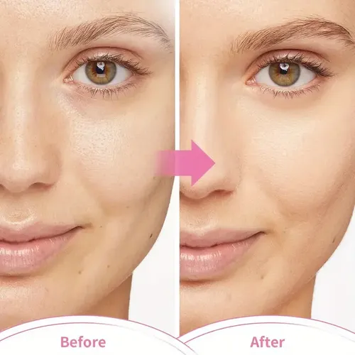 Mascarilla Facial De Gel Reutilizable Frío/calor Anti-ojeras - Imagen 3