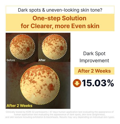 Sungboon Editor Kojic Acid Niacinamide Brightening Rice Peel - Imagen 5