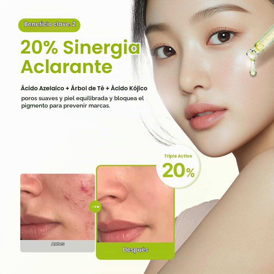 Purito Seoul Azelaic Acid 10 Kojic Tea Tree Sérum para imperfecciones- 30 ml - Imagen 2