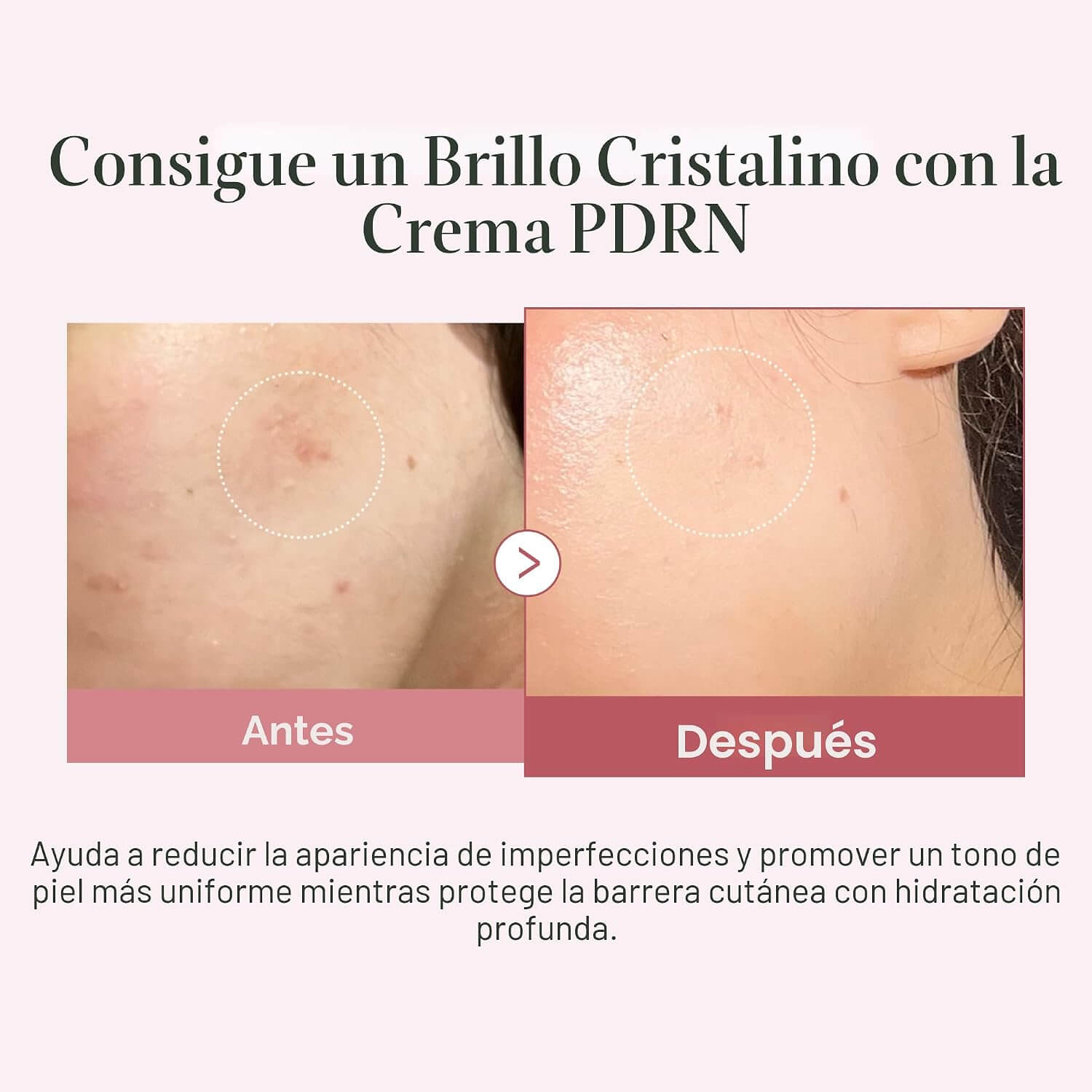 Medicube Pdrn pink hyaluronic moisturizing cream - 50ml - Imagen 4